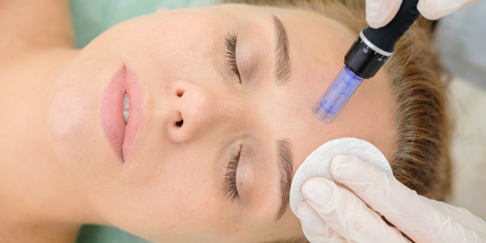 Dermapen Uygulaması