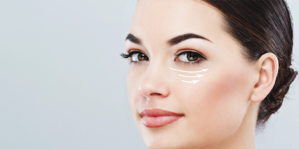 Göz Altı Işık Dolgusu